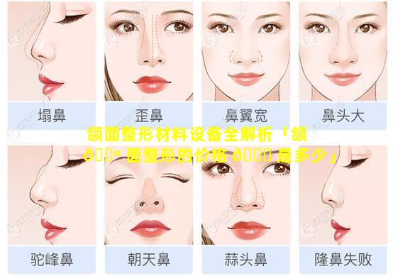 颌面整形材料设备全解析「颌 🐺 面整形的价格 🐕 是多少」